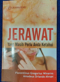 Image of Jerawat Yang Masih Perlu Anda Ketahui
